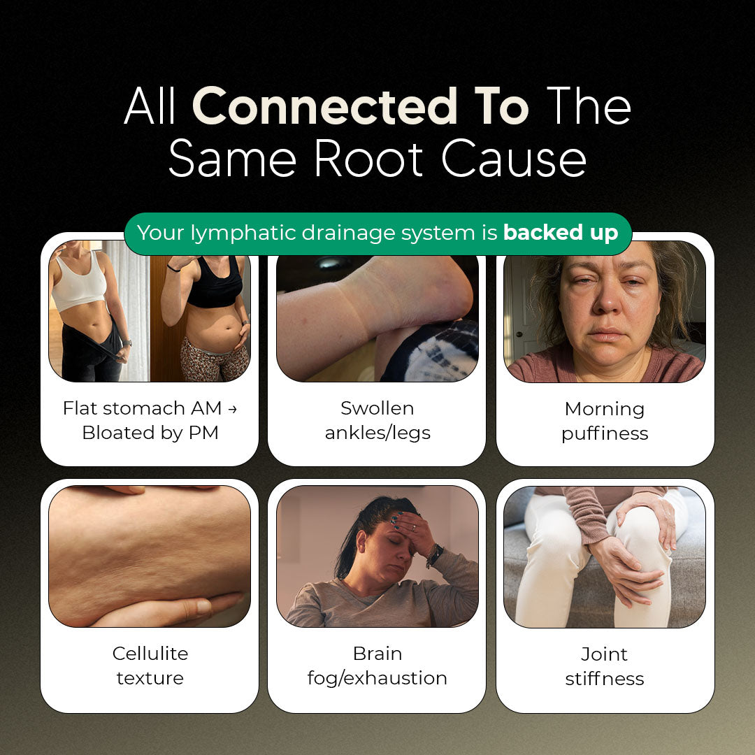 Maximum Potency Lymphatic Drainage Capsules for Cellulite Reduction & Skin Firming