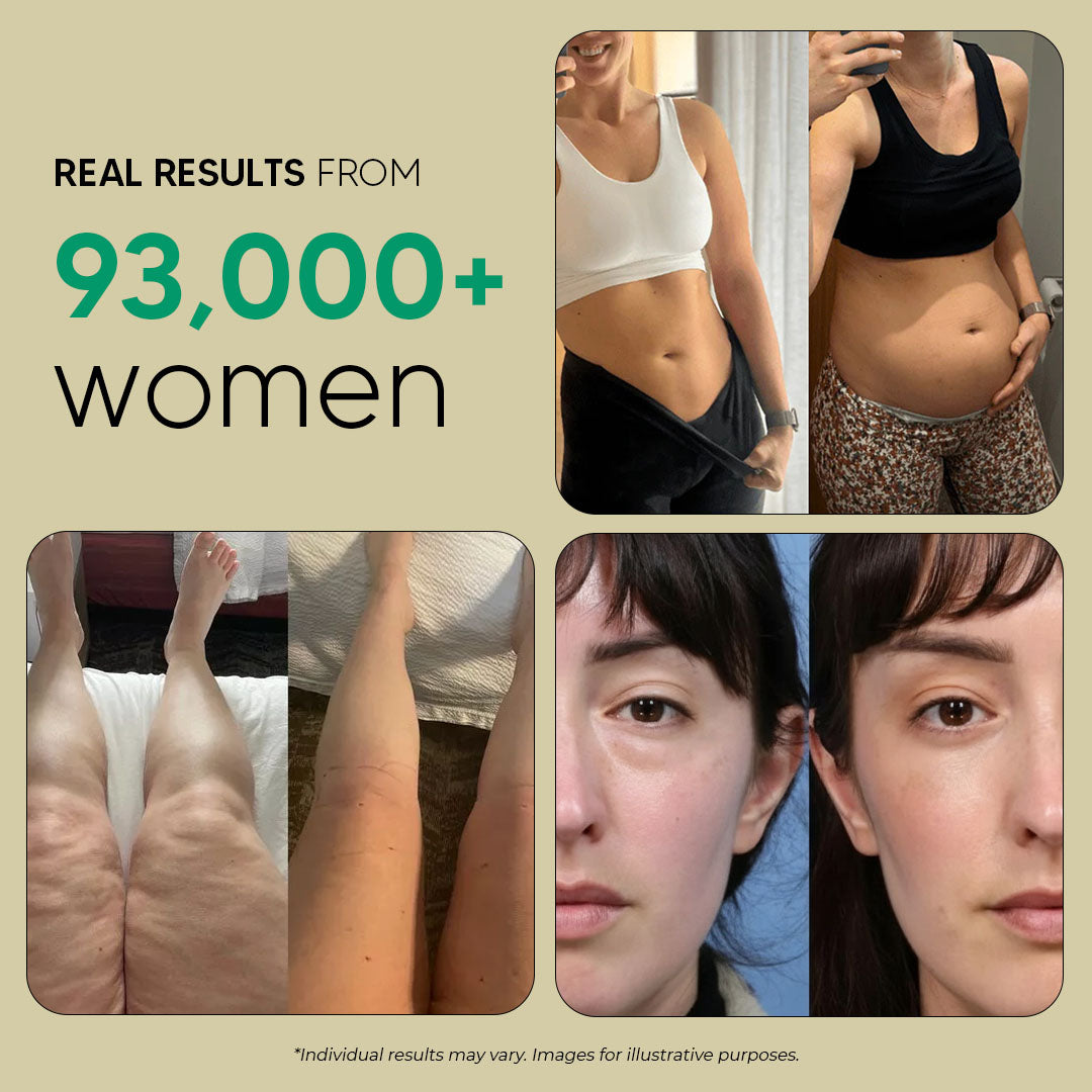 Maximum Potency Lymphatic Drainage Capsules for Cellulite Reduction & Skin Firming