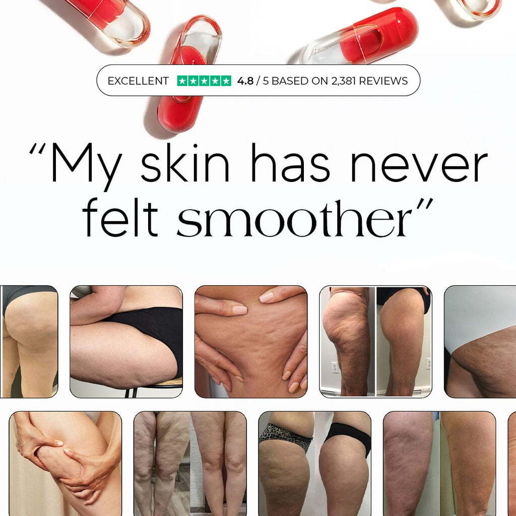 Sculptique Smooth Skin Anti-Cellulite & Lipedema Capsules - Potent 7-Ingredient Formula