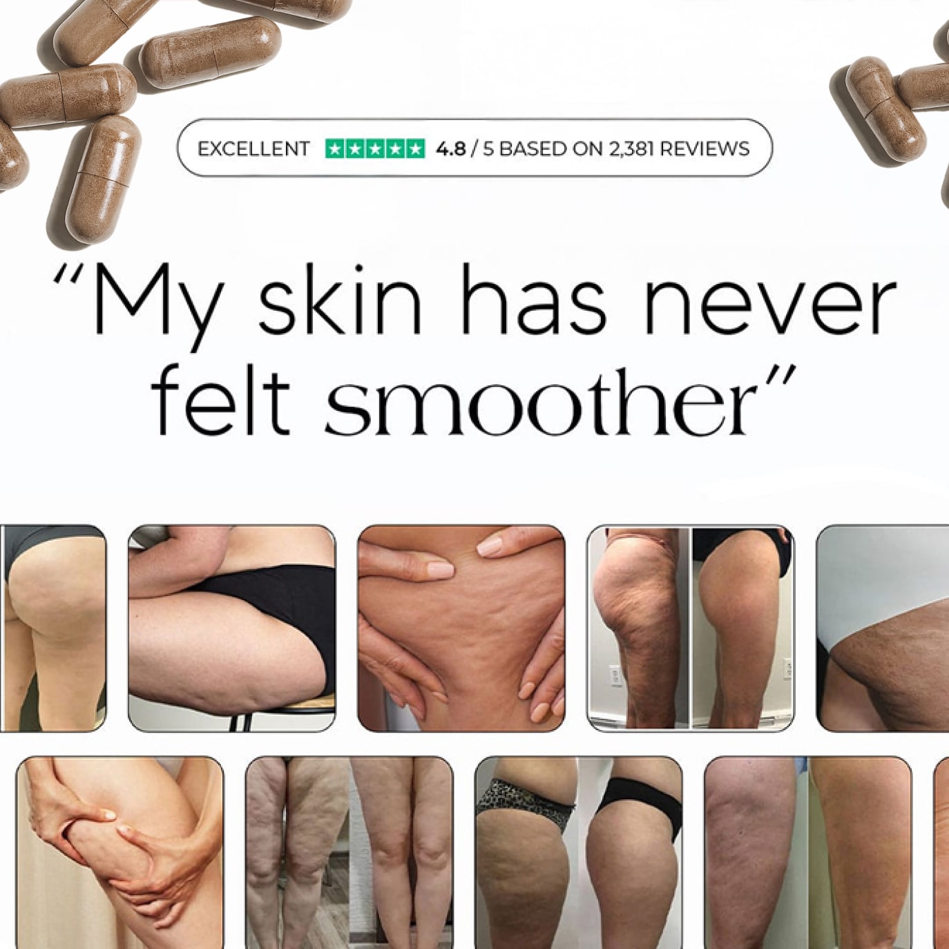 Sculptique Smooth Skin Anti-Cellulite & Lipedema Support Capsules